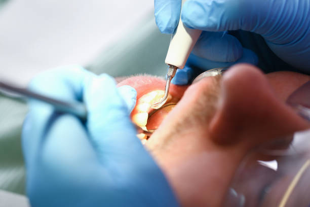 Best Emergency Care for Gum Disease in Bratenahl, OH